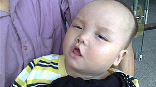 吃小瓜舌头痛,揭秘吃小瓜引发舌头痛的奥秘